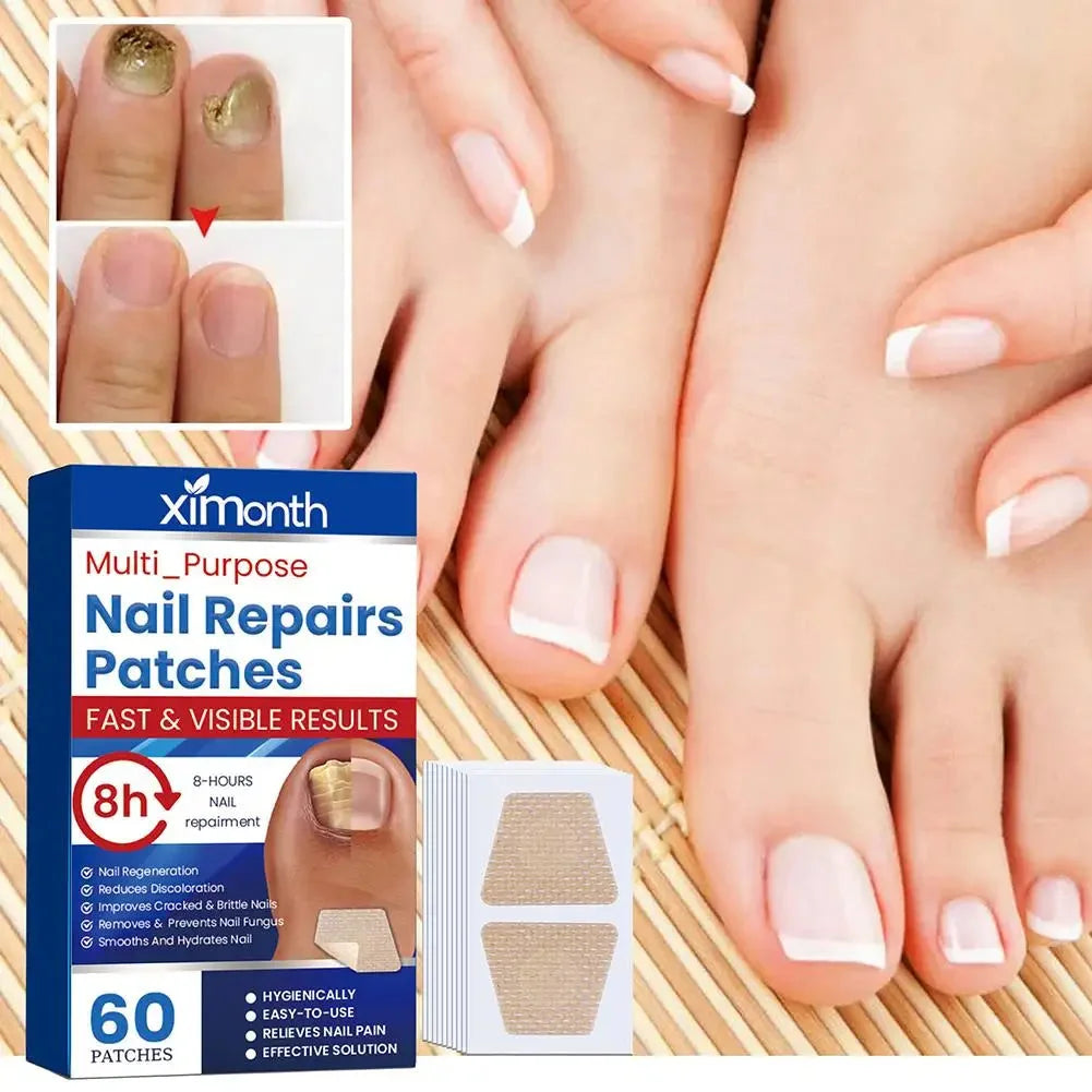 Adesivos de Restauração Discretos para Unhas com Fungos — foto 2