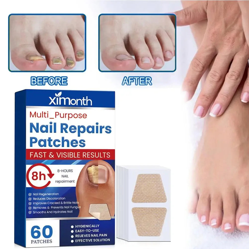 Adesivos de Restauração Discretos para Unhas com Fungos — foto 3